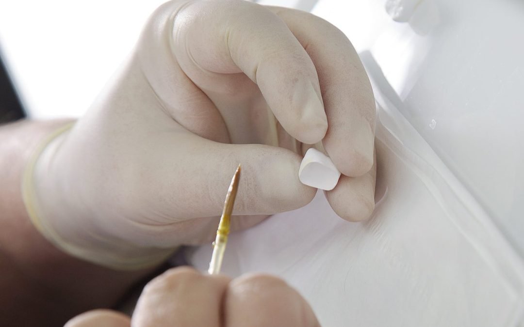 Patient’s Guide to Same-Day Crowns