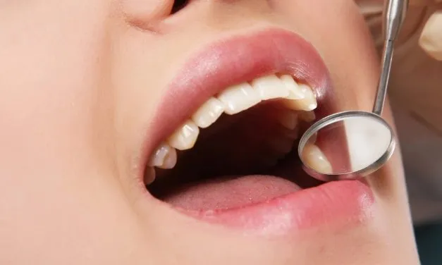 Everything You Need to Know About Tooth Extractions