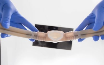 Patient’s Guide to Nitrous Oxide