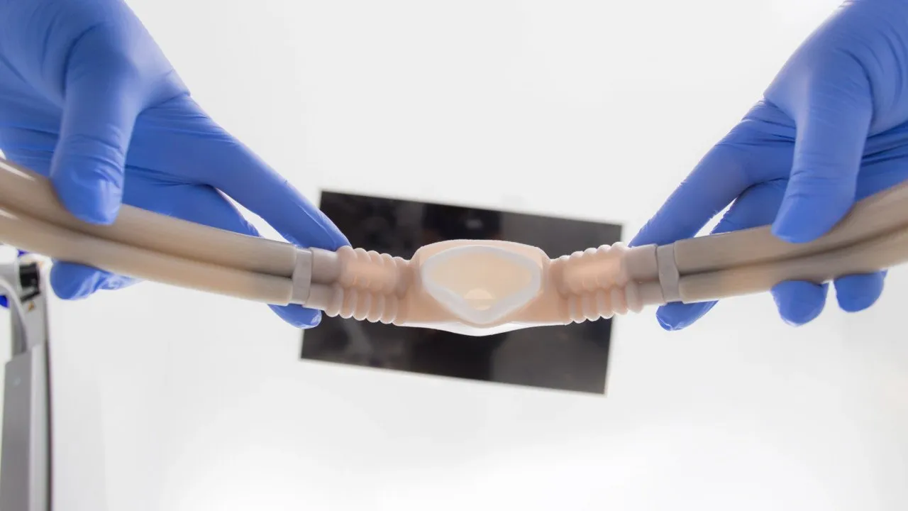 sedation dentistry nitrous oxide - York Village Dental