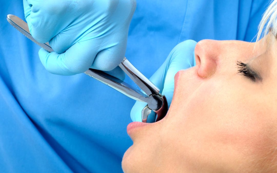 Tooth extraction York Village Dental