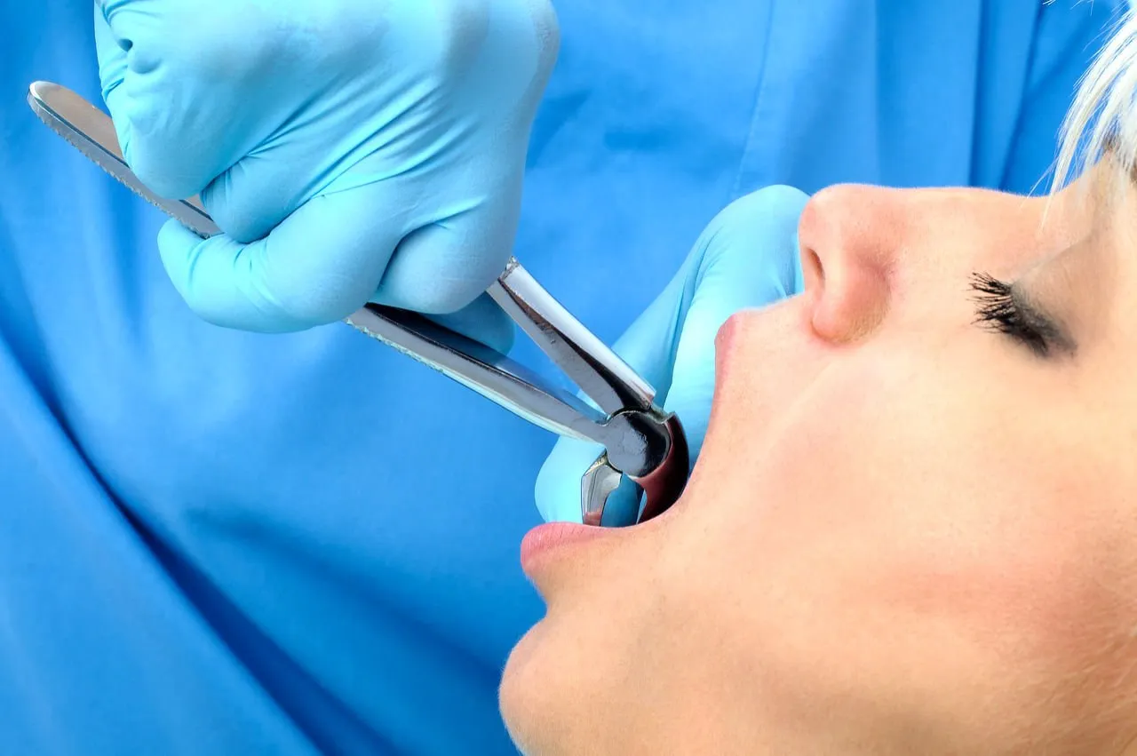 A Patient’s Guide to Tooth Extraction