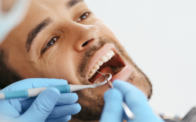 I Have Missing Teeth: What Are My Options?