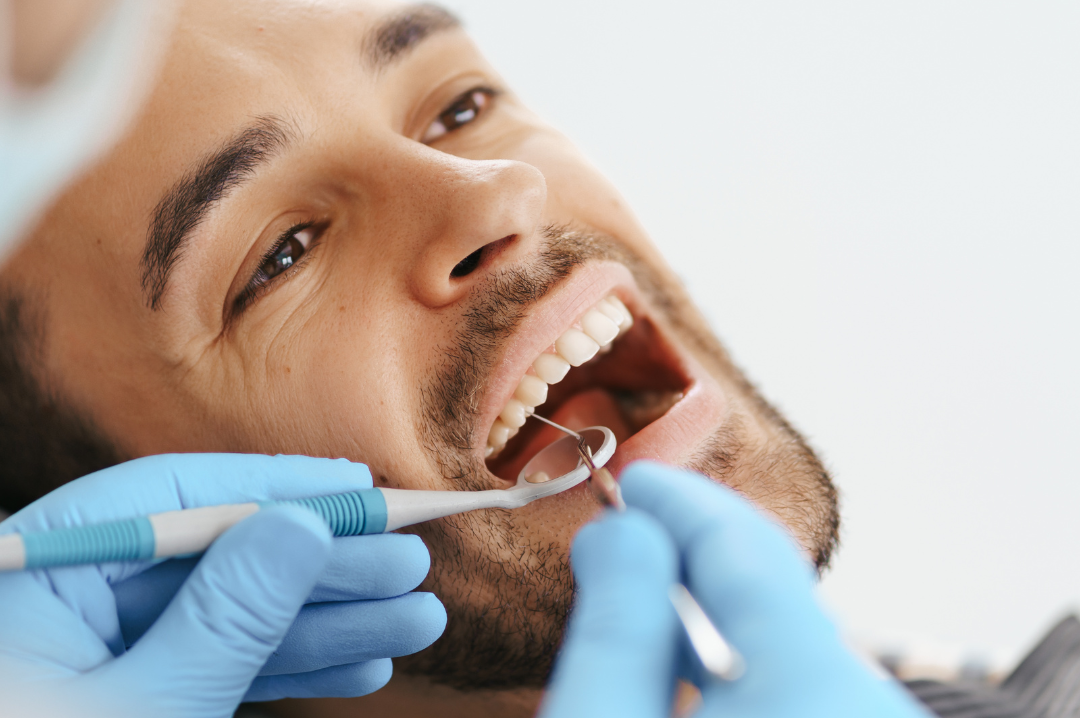 How to replace missing teeth